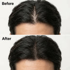 Korean Scalp Revival Bar