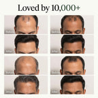 Korean Scalp Revival Bar
