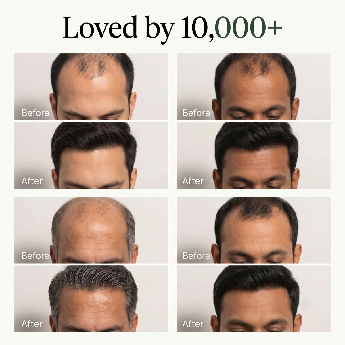 Korean Scalp Revival Bar